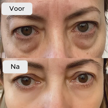 AquaRadiance™ Eye Revival Serum – Voor een Jeugdige, Stralende Blik
