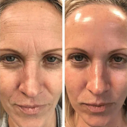 LumiDerm™ Collageen Glow Masker