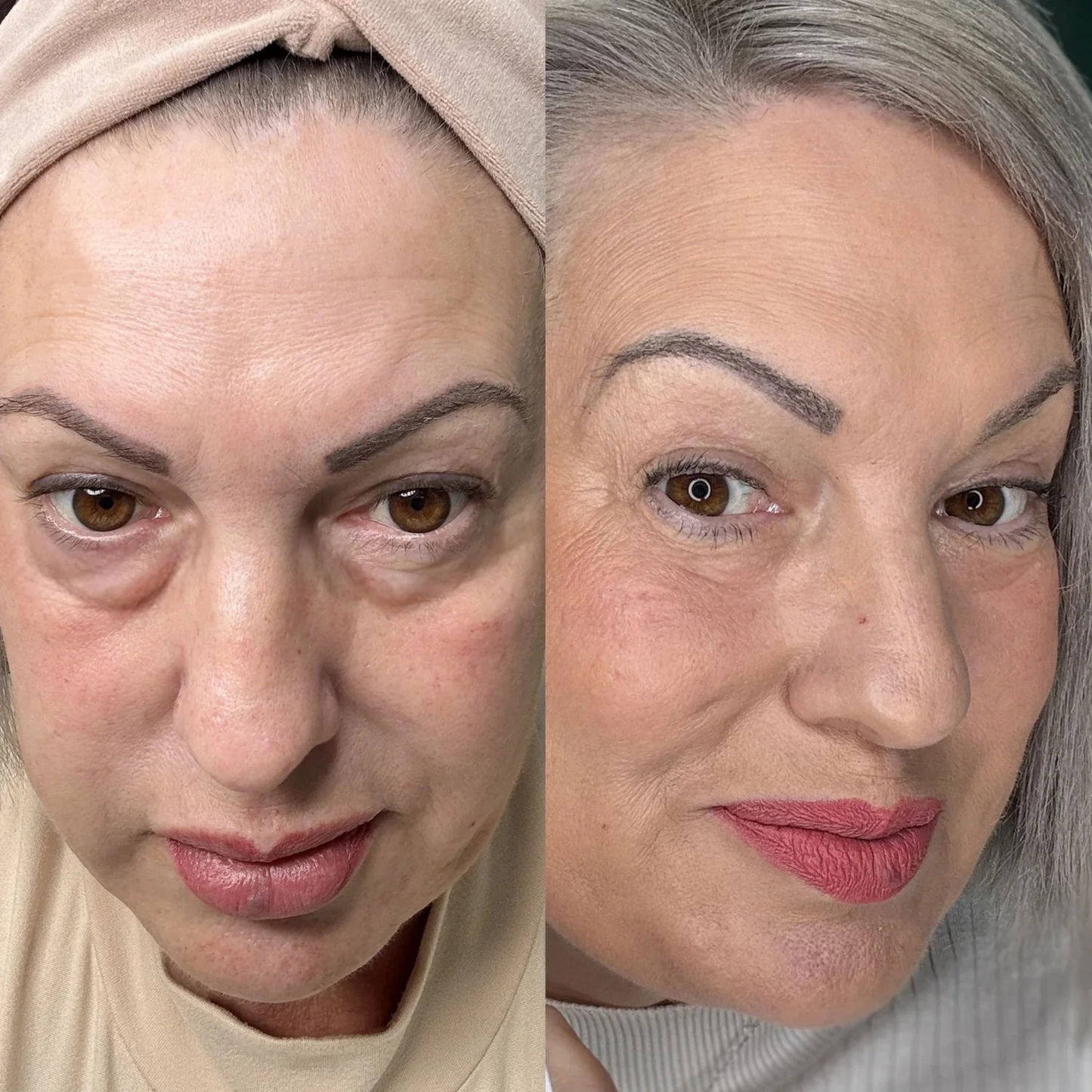 AquaRadiance™ Eye Revival Serum – Voor een Jeugdige, Stralende Blik